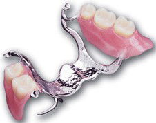 Noble Denture Design - Insurance Yet 2