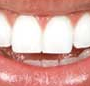 Bendigo Dentist On Hargreaves - Insurance Yet