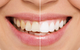 All About Smiles Kincumber - thumb 0