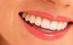 All About Smiles Kincumber - thumb 3