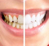 Graham johnson dental surgeon