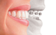 Woolgoolga Dental Centre - thumb 3