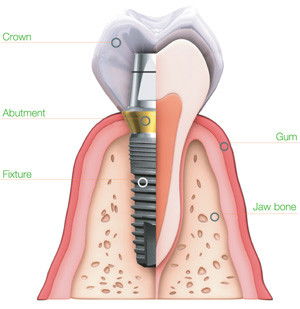 St Vincent's Dental Centre - Insurance Yet 6