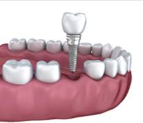 Smiles Nambour - Insurance Yet 7