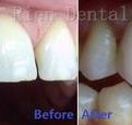 Rien Dental - House Insurance Australia