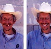 Denture Mt Gravatt - Insurance Yet