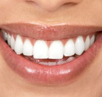 Smile Professionals - Reliable Cosmetic Dentistry in Perth - Insurance Yet