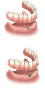 Bi & Ma Grundy - House Insurance Australia 2