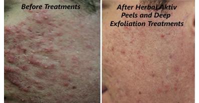 Mackay Skin Clinic - Insurance Yet 0