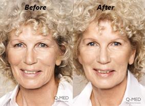 Mackay Skin Clinic - Insurance Yet 1
