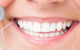 MS Dental Cardiff - thumb 5