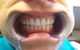 MS Dental Cardiff - thumb 8