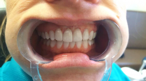 MS Dental Cardiff - House Insurance Australia 3