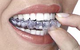 Hermitage Dental - thumb 3