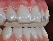 Hermitage Dental - Insurer Find 4