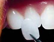 Hermitage Dental - Insurer Find 6