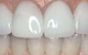 Hermitage Dental - thumb 7