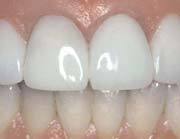 Hermitage Dental - Insurer Find 7