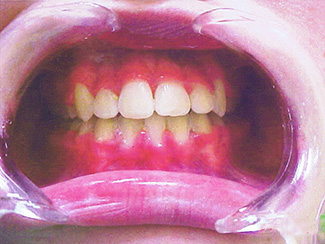 Central Gosford Orthodontics - Insurer Find 2