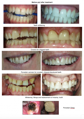 Smile Craft Dental - Insurer Find 1