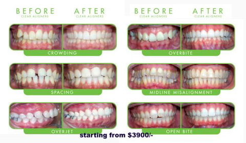 CUMULUS DENTAL - Insurance Yet 7