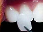 Hermitage Dental - Insurer Find 16