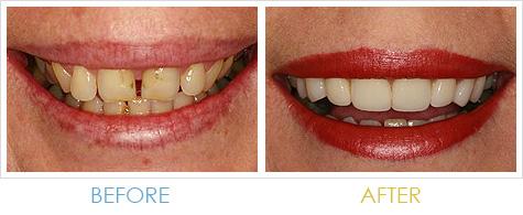 Harris Dental Boutique - Insurance Yet 1