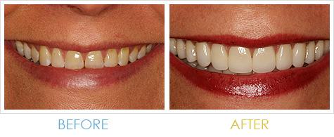 Harris Dental Boutique - Insurance Yet 2
