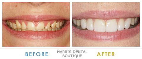 Harris Dental Boutique - Insurance Yet 4