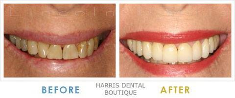 Harris Dental Boutique - Insurance Yet 5