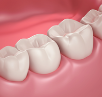 Coastal Dental Implants