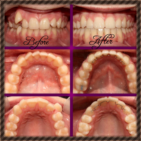 Coral Coast Dental - Insurance Yet 11