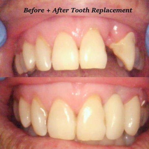 Fraser Shores Family Dental - Insurance Yet 3