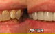 Ooralea Dental Care - thumb 4