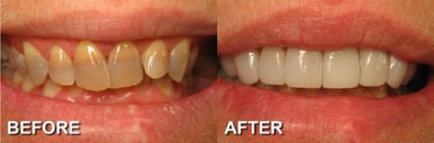 Ooralea Dental Care - Insurance Yet 4