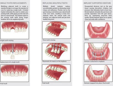 Ooralea Dental Care - Insurance Yet 5